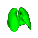 Respiratory motion modelling for radiotherapy