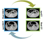 Synthetic CT generation from cone beam CT for radiotherapy treatment plan evaluation and adaptation